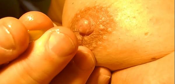  little needles in nipple